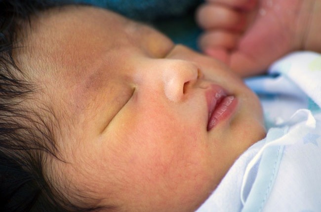 Cara Hilangkan Kuning Bayi Paling Berkesan